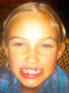 Zoe-wobbly-tooth-Quito