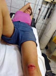 Nervously awaiting stitches in A&E!